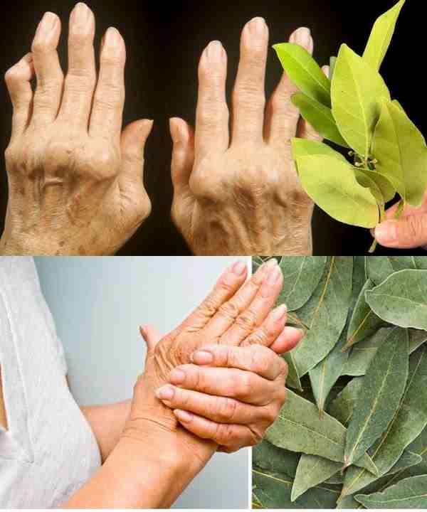 Feel Like a Teenager Again: The Incredible Joint-Healing Power of Bay Leaves