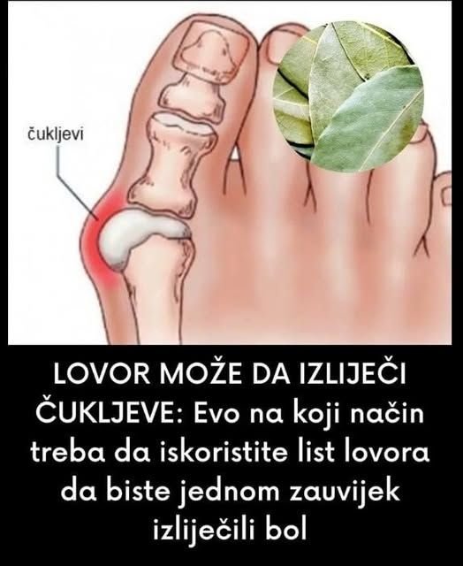LOVOR MOŽE DA IZLIJEČI ČUKLJEVE: Evo na koji način treba da iskoristite list lovora da biste jednom zauvijek izliječili bol