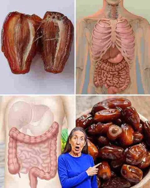 Blago podignite uzglavlje kreveta pomoću jastuka u obliku klina. Izbjegavajte teške ili začinjene obroke 2–3 sata prije spavanja. Ako često imate nadutost ili refluks, spavajte na lijevoj strani. Ove male promjene mogu značajno poboljšati kvalitet sna i jutarnju svježinu. Utjecaj na Srce i Cirkulaciju ❤️💤 Položaj u kojem spavate može utjecati i na rad srca i krvotok. Ležanje na desnoj strani može stvarati blagi pritisak na srce, posebno kod osoba s postojećim srčanim problemima poput zatajenja srca, visokog pritiska ili koronarne bolesti. Zdrave osobe to možda neće ni osjetiti, ali oni s kardiovaskularnim tegobama mogu primijetiti nelagodu, preskakanje srca ili kratkoću daha. Istraživanja pokazuju da spavanje na lijevoj strani poboljšava protok krvi i omogućava srcu da radi efikasnije tokom noći. Ovaj položaj također potiče limfni sistem, koji pomaže tijelu u detoksikaciji i uklanjanju viška tekućine. Spavanje na desnoj strani može usporiti limfnu drenažu, što dovodi do jutarnjeg oticanja lica, nogu ili osjećaja težine u udovima. Bolja cirkulacija znači bolji san i regeneraciju — tijelo lakše isporučuje kisik, obnavlja tkiva i izbacuje toksine. Bolovi u Mišićima i Ramenima 💪🦴 Ako se budite sa ukočenim vratom ili bolnim ramenom, možda predugo spavate na desnoj strani. Ovaj položaj stavlja pritisak na rame, kuk i ruku, što s vremenom uzrokuje napetost i bol u mišićima. Najčešće pritužbe uključuju: Bol u ramenu ili ograničeno kretanje ruke ujutro. Trnce ili utrnulost zbog pritiska na živce. Bol u donjem dijelu leđa zbog neravnomjerne raspodjele težine. 🛏️ Kako ublažiti bolove tokom spavanja: Koristite ortopedski ili memorijski jastuk za poravnanje vrata i kičme. Stavite mali jastučić između koljena da rasteretite kukove. Povremeno promijenite položaj — ne spavajte stalno na istoj strani. Odaberite madrac koji ravnomjerno podržava tijelo. Ovi savjeti mogu smanjiti napetost i pomoći vam da se probudite odmorni i bez ukočenosti. Koja Strana Je Najbolja za Vas? 🌙 Ne postoji savršen položaj za svakoga, ali spavanje na lijevoj strani najčešće se smatra najzdravijim — posebno za osobe s refluksom, probavnim smetnjama, srčanim ili cirkulacijskim problemima. Spavanje na leđima takođe može biti korisno jer kičma ostaje u neutralnom položaju, ali može pogoršati hrkanje i apneju. Ako spavate na stomaku, imajte na umu da taj položaj može opteretiti vrat i kičmu.