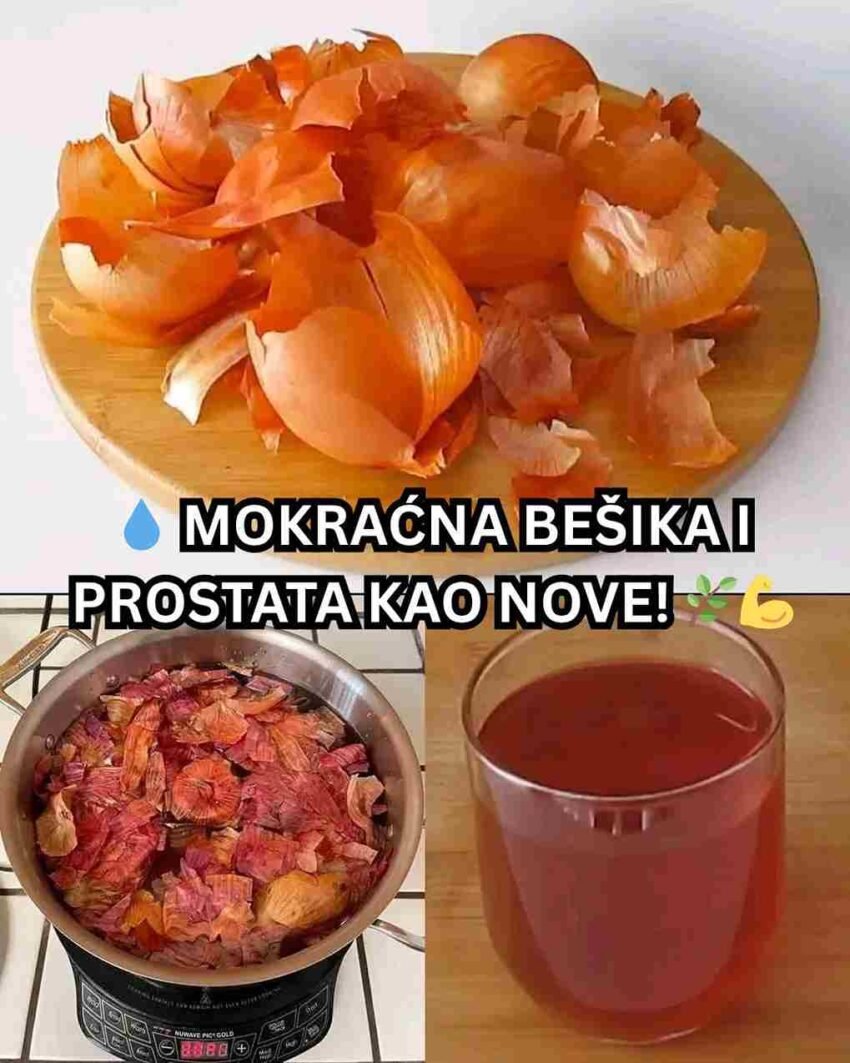 🍯 Kako se priprema? Za pripremu čaja potrebno je: Ljuske 1–2 luka (po mogućnosti crvenog) 2 šolje vode Operite ljuske, ubacite ih u ključalu vodu i kuhajte 10–15 minuta. Potom poklopite i ostavite da odstoji još 5 minuta. Procijedite i pijte toplo. Po želji dodajte kašičicu meda ili limunov sok. 💪 Zdravstvene koristi ✅ Smanjuje upalu prostate i bešike ✅ Djeluje diuretski – podstiče izbacivanje toksina ✅ Poboljšava rad bubrega ✅ Pomaže kod povišenog pritiska i lošeg holesterola ✅ Jača imunitet i čisti organizam ☕ Kako koristiti? Za opštu detoksikaciju pijte jednu šolju dnevno, najbolje uveče. Ako imate problema sa prostatom ili bešikom, preporučuju se dvije šolje dnevno u trajanju od 1–2 sedmice, uz kratku pauzu nakon toga. ⚠️ Napomena Koristite organske ljuske i izbjegavajte one prskane pesticidima. Osobe sa hroničnim bolestima bubrega ili alergijama na luk trebaju se prethodno posavjetovati s ljekarom. Ovaj zaboravljeni narodni lijek dokaz je da priroda nudi jednostavna rješenja za dugotrajno zdravlje – bez hemije i skupih lijekova. 🌱